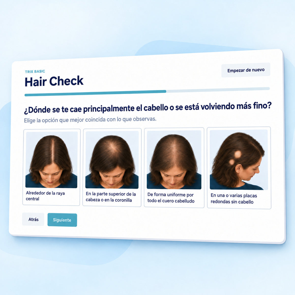 Hair Check de TRIX Basic con opciones visuales para distintos patrones de caída del cabello.