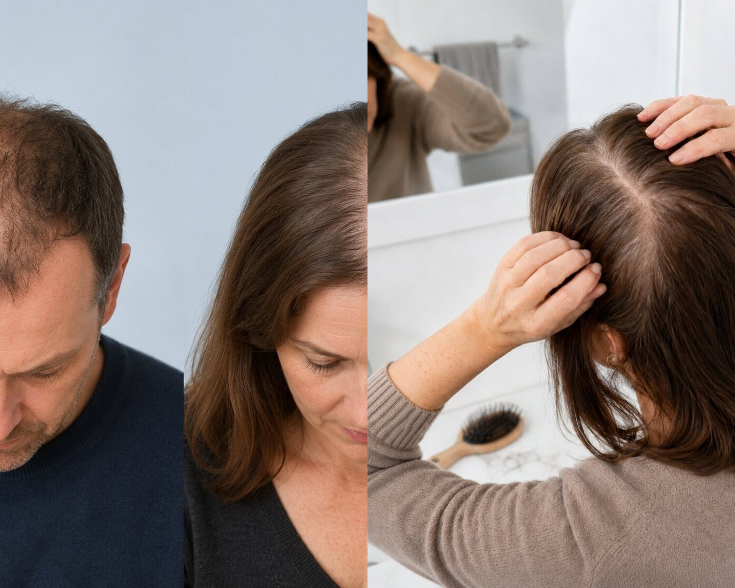Comparación entre el adelgazamiento del cabello con patrón y la caída difusa del cabello