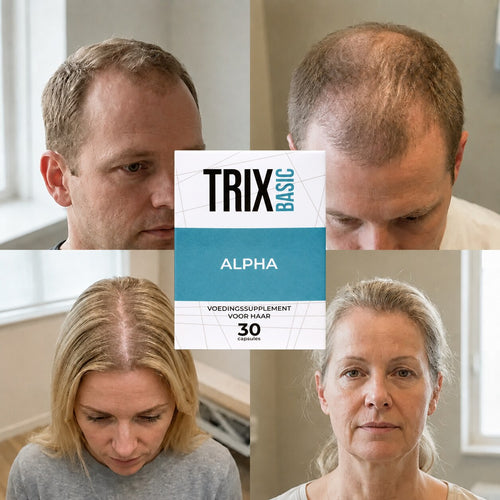 TRIX Basic Alpha para patrones de caída del cabello compatibles con alopecia androgénica en hombres y mujeres.
